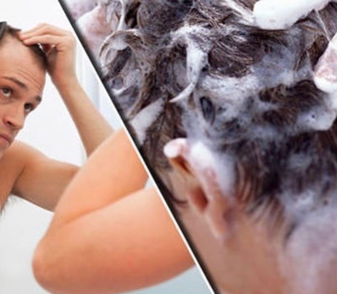 Shop Nism NewHair Biofactors and Kalo. Nisim is an all natural, herbal based shampoo and extract, safely and effectively removes build up of sweat, oils, and dirt the first step in controlling the factors that can contribute to hair loss.