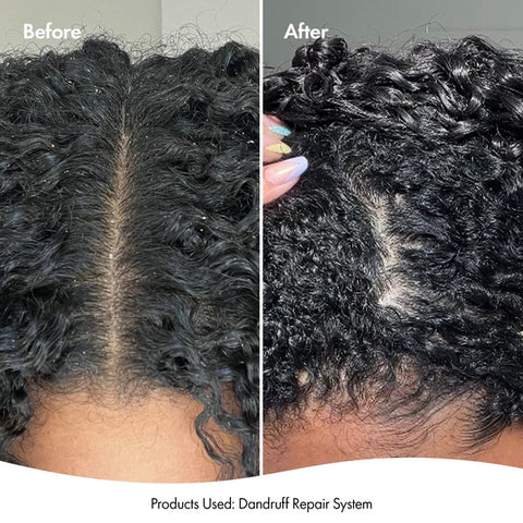Bondi Boost Leave-In Scalp Serum