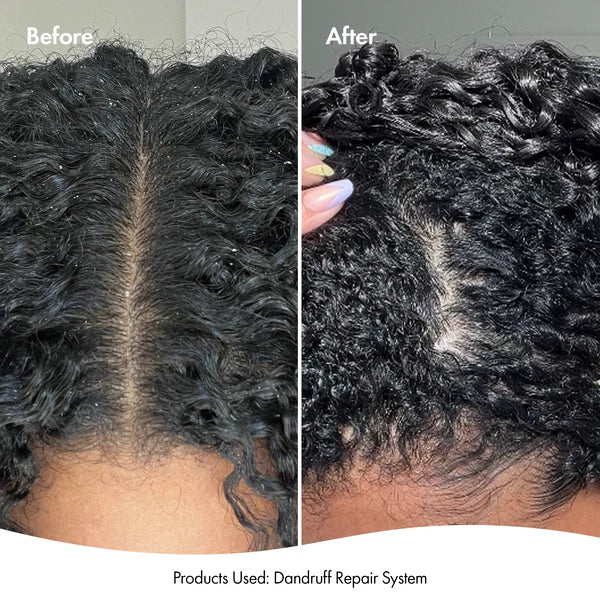 Bondi Boost Leave-In Scalp Serum