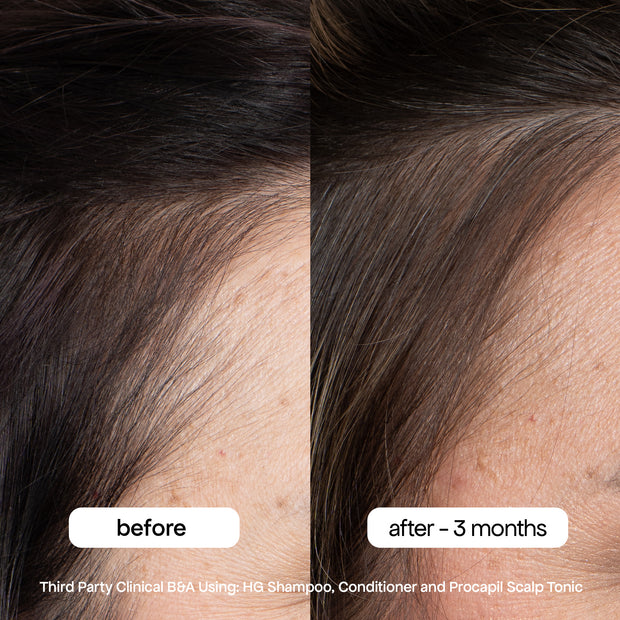 Bondi Boost Anti-Thinning Procapil® Scalp Tonic