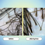 Bondi Boost HG Clarifying Scalp & Hair Rinse